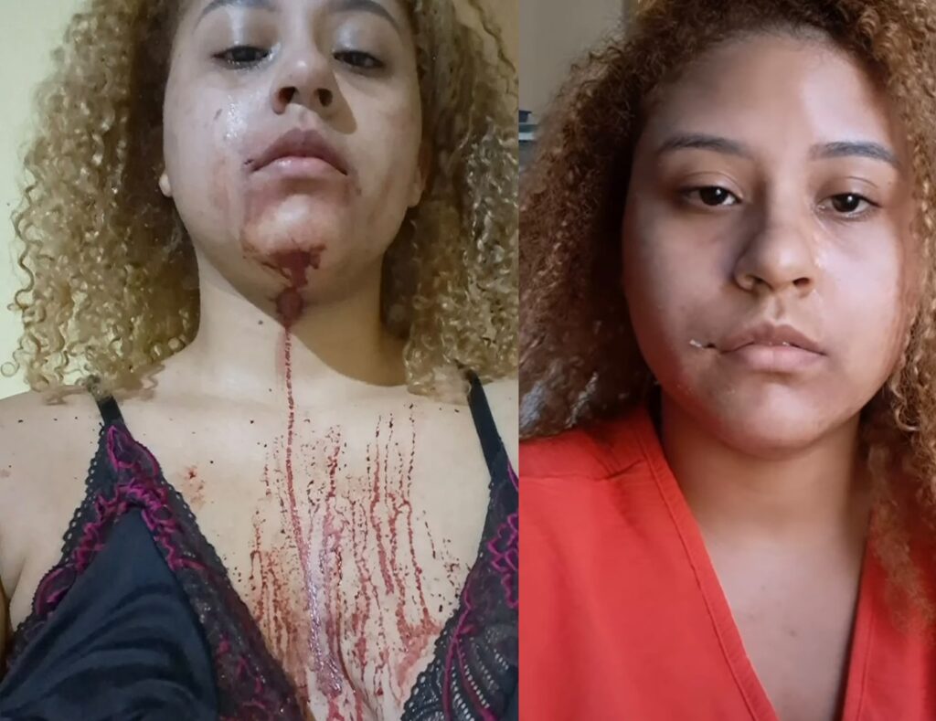 Jovem denuncia agressão e ameaça de PM durante em MT