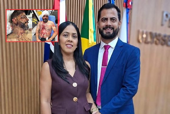 Vereador e esposa recebem alta após ataque que deixou família refém em Rondonópolis
